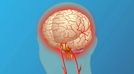 添翼ISPN/RN專業(yè)課&nbsp;66章&nbsp;神經(jīng)系統(tǒng)