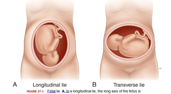 添翼2017-2018年專業(yè)課&nbsp;27章&nbsp;臨產(chǎn)與分娩